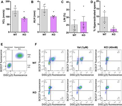 Membrane potential hyperpolarization: a critical factor in acrosomal exocytosis and fertilization in sperm within the female reproductive tract